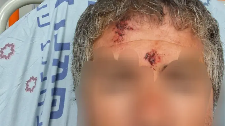 Rising Tensions: Violent clashes near Israeli farm leave two injured