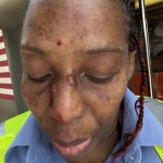 MTA worker recovering from brain surgery ‘viciously’ assaulted by fare evaders at Brooklyn subway station: cops
