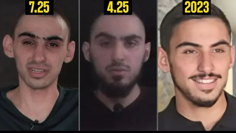 Hostages Evyatar David and Rom Braslavski have lost about 40% of their body weight