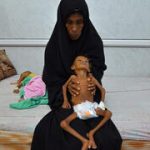 85,000 dead children: Yemen’s crisis far worse than Gaza — yet overlooked by the world