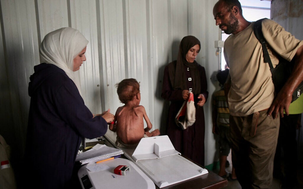 UN says 13,000 children treated for malnutrition in Gaza in July as aid trickles in