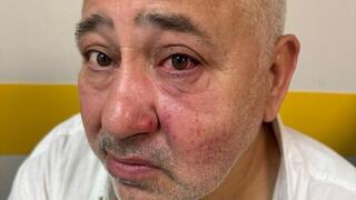 Jewish man wearing kippah, Star of David attacked northeast of Paris