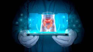 AI use in colonoscopies may erode doctors’ tumor detection skills, study finds