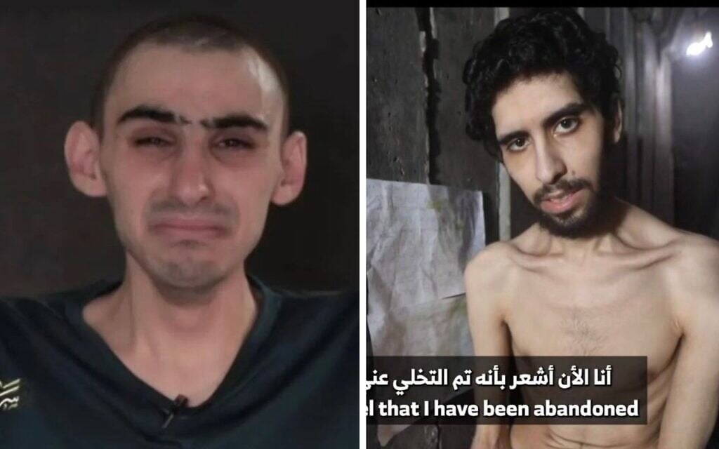 Medical report: Hostages face ‘immediate risk of death’ from ‘systematic starvation’