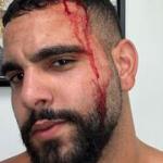 Israeli man attacked by pro-Palestinian crowd in Los Angeles