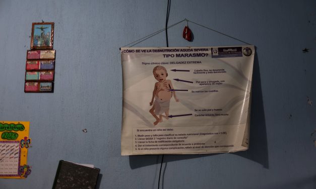 If there’s famine in Gaza, there’s famine almost everywhere – opinion