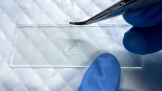 Israeli researchers develop smart biological glue that could replace stitches