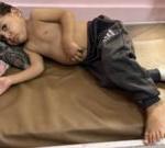 Gaza children dying as they wait for Israel to enable evacuations