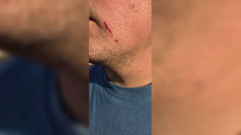 Arabs attacked Migdalim farm owner with stones near Migdalim