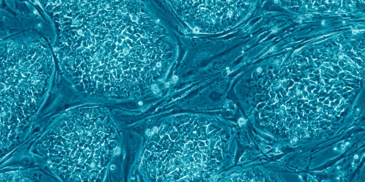 AI, stem cells take center stage at Reichman University medical summit