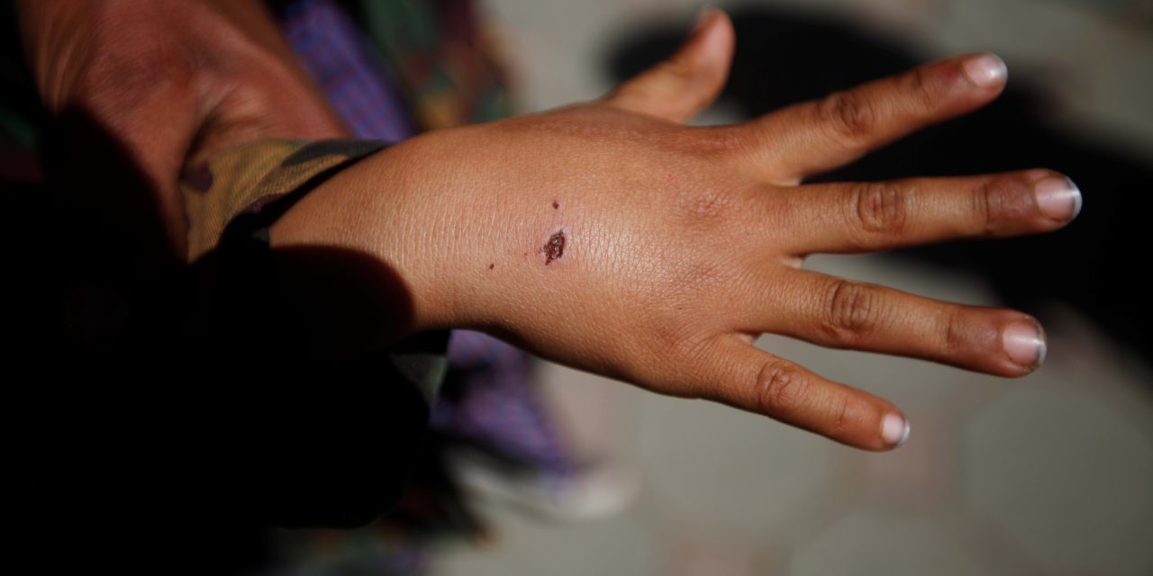 Rabid dog kept in Haifa kindergarten, multiple children attacked