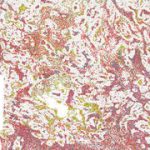 Israeli team develops new treatment that helps immune system fight tumors more effectively