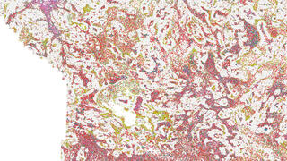 Israeli team develops new treatment that helps immune system fight tumors more effectively