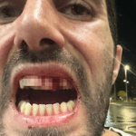 New Zealand man jailed for assaulting Israeli tourist in Christchurch bar