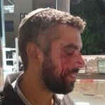 Rabbi attacked in Jaffa, lightly injured: ‘a young man lunged at me shouting Allahu Akbar’