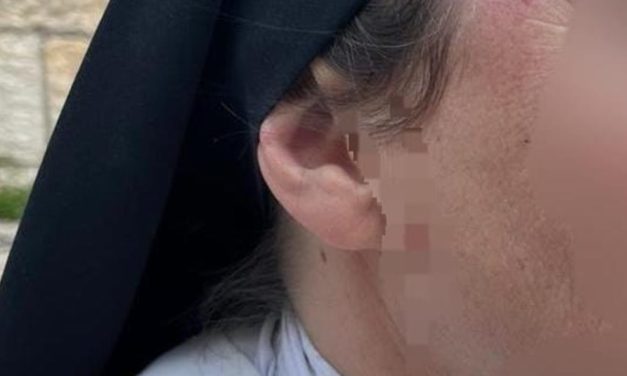 ‘Assault on city’s fundamental values’: Attack on nun in Jerusalem sparks widespread condemnation