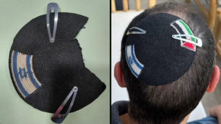 Police detain man wearing kippah with Israeli and Palestinian flags on it