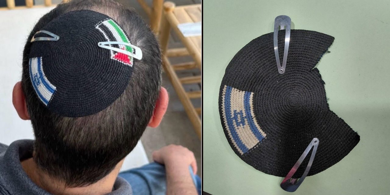 His kippah was a symbol of coexistence. Israeli police officers seized and destroyed it.
