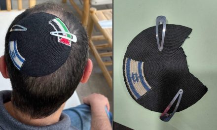 His kippah was a symbol of coexistence. Israeli police officers seized and destroyed it.