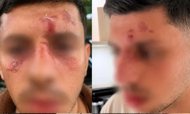 London: Young man spoke Hebrew and was attacked by masked men