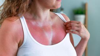 Teens discovered this weather app feature — and doctors are horrified
