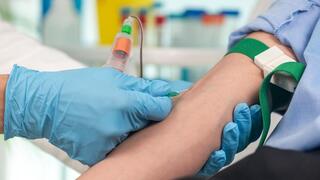 Young adult colorectal cancer rates climb as new blood test option joins screening guidelines