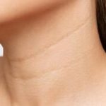 Why the neck ages faster than the face and what can help reverse it
