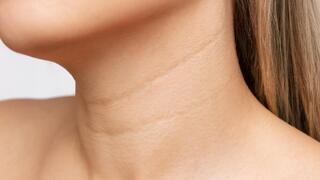 Why the neck ages faster than the face and what can help reverse it