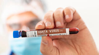 We can relax: Hantavirus is difficult to catch – it’s the next pandemic we have to be worried about