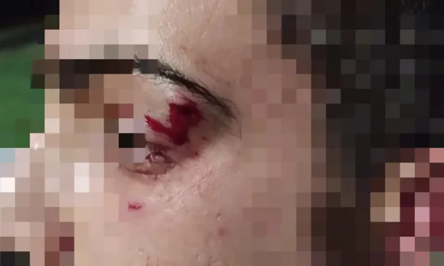 Police to pay tens of thousands of shekels for wrongful arrest