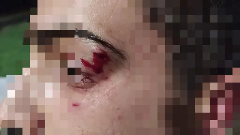 Police to pay tens of thousands of shekels for wrongful arrest