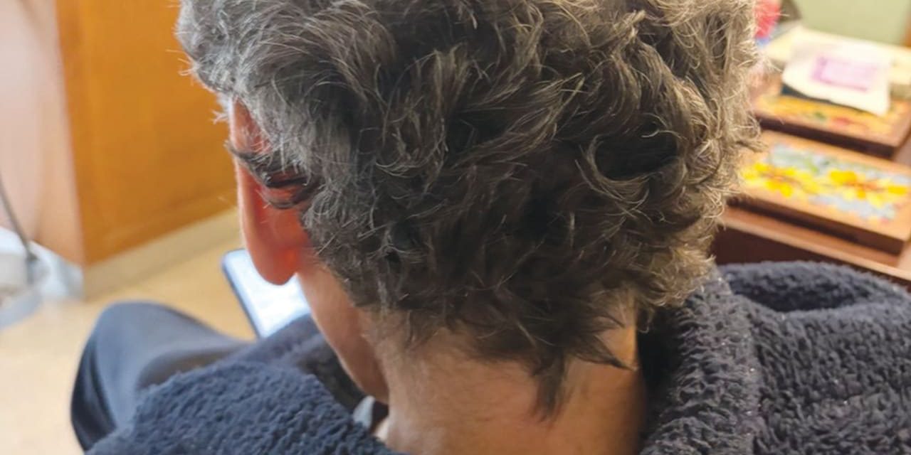 How cancer treatment gave me curly hair and a new perspective – opinion