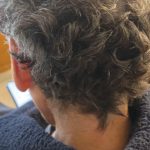 How cancer treatment gave me curly hair and a new perspective – opinion
