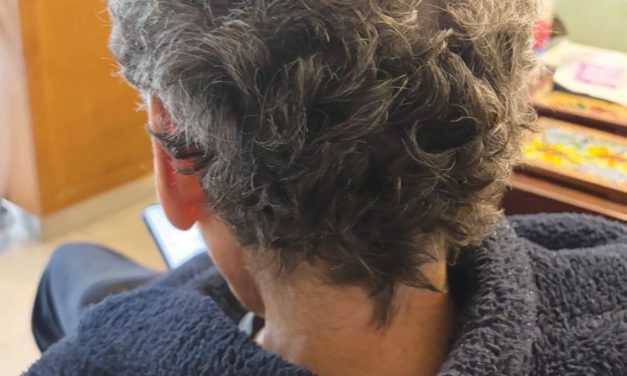 How cancer treatment gave me curly hair and a new perspective – opinion