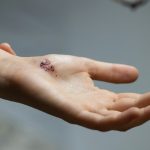 A personal injury guide for Israeli-Americans in California: Auto accidents and insurance
