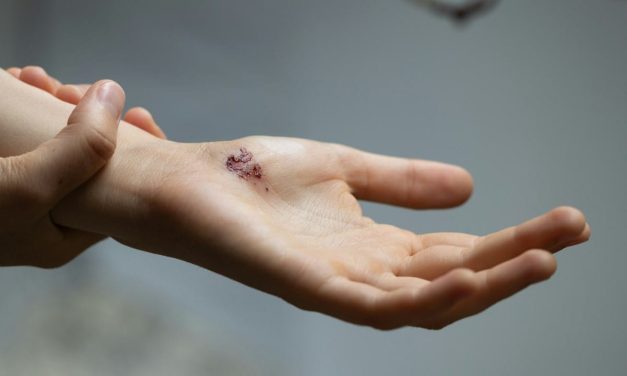 A personal injury guide for Israeli-Americans in California: Auto accidents and insurance
