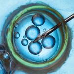 Man discovers at 29 he was conceived with wrong sperm, sparks NIS 7.3m lawsuit