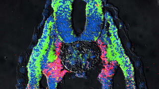 A 136-year-old idea about kidney evolution gets new support