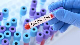 Syphilis cases surge in Israel, rising 120% over four years
