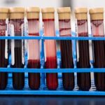 A single blood test finds more early cancers than Britain’s screening programs combined in a trial