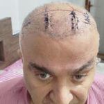 ‘Beaten until unconscious, not a single bone left intact: Testimony of new wave of repression in Iran