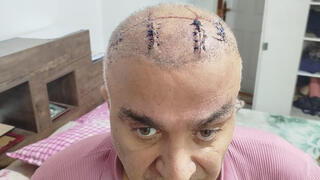 ‘Beaten until unconscious, not a single bone left intact: Testimony of new wave of repression in Iran