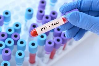 Israel’s HIV fight falters as at least 1 in 10 carriers may not know they are infected