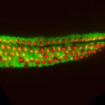 Breakthrough Israeli study finds potential path to reversing hearing loss