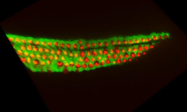 Breakthrough Israeli study finds potential path to reversing hearing loss