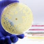 Israeli researchers uncover hidden mechanism behind rapid antibiotic resistance