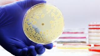 Israeli researchers uncover hidden mechanism behind rapid antibiotic resistance