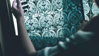 The surprising link between vitamin C levels and brain health