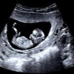 Longevity may begin before birth, new research suggests
