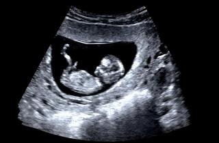 Longevity may begin before birth, new research suggests